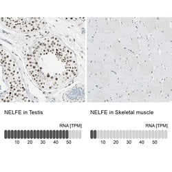 Invitrogen RDBP Polyclonal Antibody 100 &mu;L; Unconjugated:Antibodies,