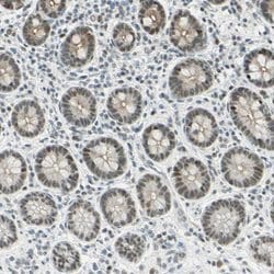 Invitrogen RDBP Polyclonal Antibody 100 &mu;L; Unconjugated:Antibodies,