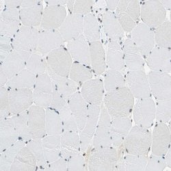 Invitrogen RDBP Polyclonal Antibody 100 &mu;L; Unconjugated:Antibodies,