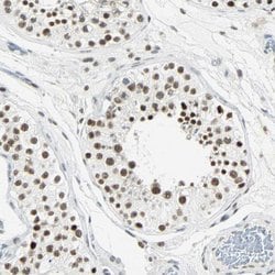 Invitrogen RDBP Polyclonal Antibody 100 &mu;L; Unconjugated:Antibodies,