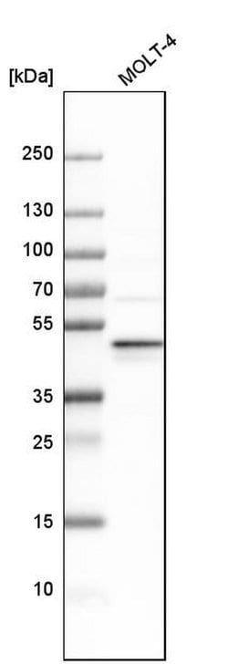Invitrogen RDBP Polyclonal Antibody 100 &mu;L; Unconjugated:Antibodies,