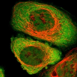 Invitrogen CYTIP Polyclonal Antibody 100 &mu;L; Unconjugated:Antibodies,