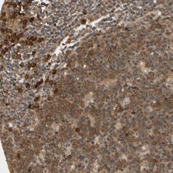 Invitrogen CYTIP Polyclonal Antibody 100 &mu;L; Unconjugated:Antibodies,