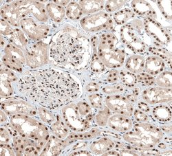 Invitrogen ALKBH5 Polyclonal Antibody 100 &mu;L | Buy Online | Invitrogen&trade; | Fisher Scientific