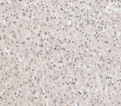 Invitrogen ALKBH5 Polyclonal Antibody 100 &mu;L | Buy Online | Invitrogen&trade; | Fisher Scientific