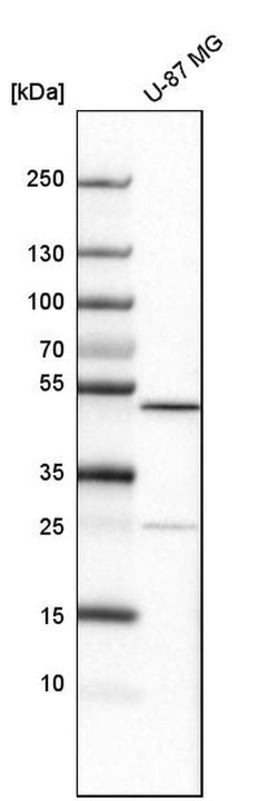 Invitrogen ALKBH5 Polyclonal Antibody 100 &mu;L | Buy Online | Invitrogen&trade; | Fisher Scientific