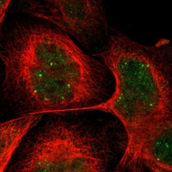 Invitrogen CRCP Polyclonal Antibody 100 &mu;L; Unconjugated:Antibodies,