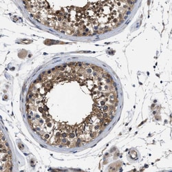 Invitrogen CRCP Polyclonal Antibody 100 &mu;L; Unconjugated:Antibodies,