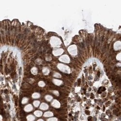 Invitrogen ZNF690 Polyclonal Antibody 100 &mu;L; Unconjugated:Antibodies,