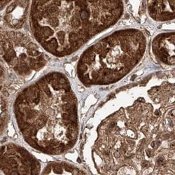 Invitrogen ZNF690 Polyclonal Antibody 100 &mu;L; Unconjugated:Antibodies,