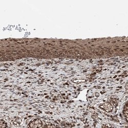 Invitrogen ZNF690 Polyclonal Antibody 100 &mu;L; Unconjugated:Antibodies,