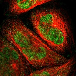 Invitrogen PGBD1 Polyclonal Antibody 100 &mu;L; Unconjugated:Antibodies,