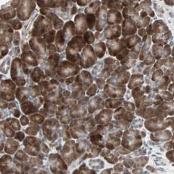 Invitrogen PGBD1 Polyclonal Antibody 100 &mu;L; Unconjugated:Antibodies,