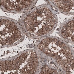 Invitrogen LSR Polyclonal Antibody 100 &mu;L | Buy Online | Invitrogen&trade; | Fisher Scientific