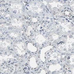 Invitrogen LSR Polyclonal Antibody 100 &mu;L | Buy Online | Invitrogen&trade; | Fisher Scientific