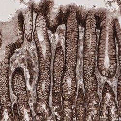 Invitrogen LSR Polyclonal Antibody 100 &mu;L | Buy Online | Invitrogen&trade; | Fisher Scientific