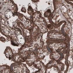 Invitrogen LSR Polyclonal Antibody 100 &mu;L | Buy Online | Invitrogen&trade; | Fisher Scientific
