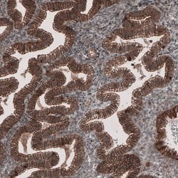 Invitrogen LSR Polyclonal Antibody 100 &mu;L | Buy Online | Invitrogen&trade; | Fisher Scientific