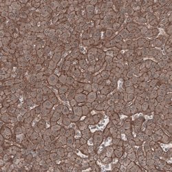 Invitrogen LSR Polyclonal Antibody 100 &mu;L | Buy Online | Invitrogen&trade; | Fisher Scientific