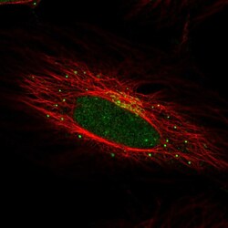 Invitrogen SPINK4 Polyclonal Antibody 100 &mu;L; Unconjugated:Antibodies,