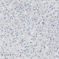 Invitrogen SPINK4 Polyclonal Antibody 100 &mu;L; Unconjugated:Antibodies,