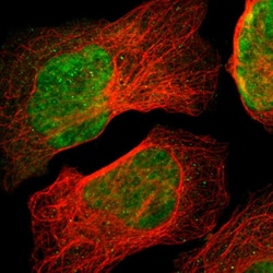Invitrogen ZSCAN30 Polyclonal Antibody 100 &mu;L; Unconjugated:Antibodies,