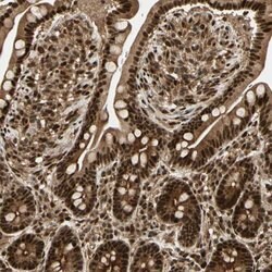 Invitrogen ZSCAN30 Polyclonal Antibody 100 &mu;L; Unconjugated:Antibodies,