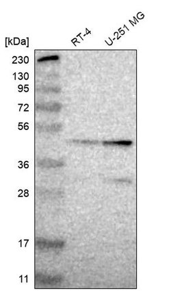 Invitrogen ZSCAN30 Polyclonal Antibody 100 &mu;L; Unconjugated:Antibodies,