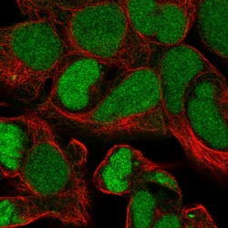 Invitrogen ZNF435 Polyclonal Antibody 100 &mu;L; Unconjugated:Antibodies,