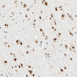 Invitrogen ZNF435 Polyclonal Antibody 100 &mu;L; Unconjugated:Antibodies,