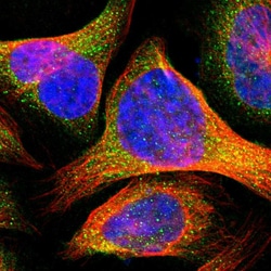 Invitrogen TCTA Polyclonal Antibody 100 &mu;L; Unconjugated:Antibodies,