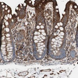 Invitrogen TCTA Polyclonal Antibody 100 &mu;L; Unconjugated:Antibodies,