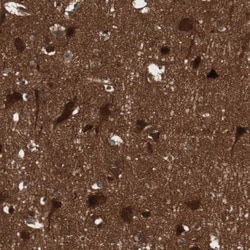 Invitrogen cGKII Polyclonal Antibody 100 &mu;L; Unconjugated:Antibodies,