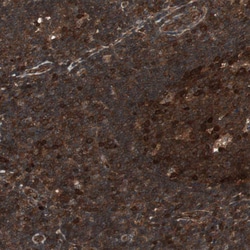 Invitrogen cGKII Polyclonal Antibody 100 &mu;L; Unconjugated:Antibodies,