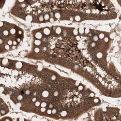 Invitrogen cGKII Polyclonal Antibody 100 &mu;L; Unconjugated:Antibodies,