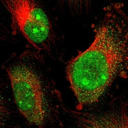 Invitrogen RCOR3 Polyclonal Antibody 100 &mu;L; Unconjugated:Antibodies,