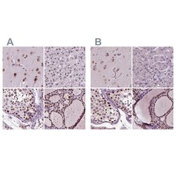 Invitrogen RCOR3 Polyclonal Antibody 100 &mu;L; Unconjugated:Antibodies,