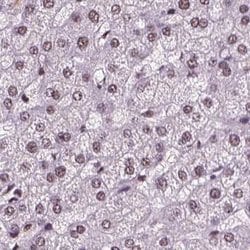 Invitrogen RCOR3 Polyclonal Antibody 100 &mu;L; Unconjugated:Antibodies,