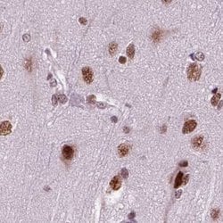 Invitrogen RCOR3 Polyclonal Antibody 100 &mu;L; Unconjugated:Antibodies,
