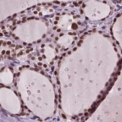 Invitrogen RCOR3 Polyclonal Antibody 100 &mu;L; Unconjugated:Antibodies,