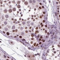 Invitrogen RCOR3 Polyclonal Antibody 100 &mu;L; Unconjugated:Antibodies,