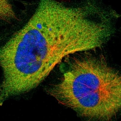 Invitrogen PNCK Polyclonal Antibody 100 &mu;L; Unconjugated:Antibodies,