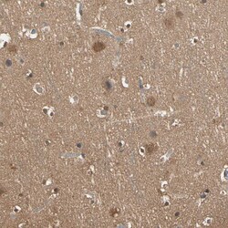 Invitrogen PNCK Polyclonal Antibody 100 &mu;L; Unconjugated:Antibodies,
