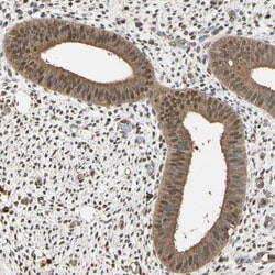 Invitrogen PNCK Polyclonal Antibody 100 &mu;L; Unconjugated:Antibodies,
