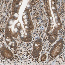 Invitrogen PNCK Polyclonal Antibody 100 &mu;L; Unconjugated:Antibodies,
