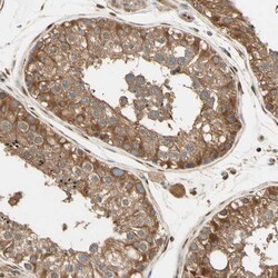 Invitrogen PNCK Polyclonal Antibody 100 &mu;L; Unconjugated:Antibodies,