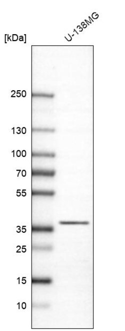 Invitrogen CAPZA2 Polyclonal Antibody 100 &mu;L | Buy Online | Invitrogen&trade; | Fisher Scientific