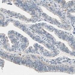 Invitrogen WIPI1 Polyclonal Antibody 100 &mu;L; Unconjugated:Antibodies,