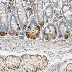 Invitrogen WIPI1 Polyclonal Antibody 100 &mu;L; Unconjugated:Antibodies,