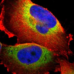 Invitrogen P4HA1 Polyclonal Antibody 100 &mu;L; Unconjugated:Antibodies,